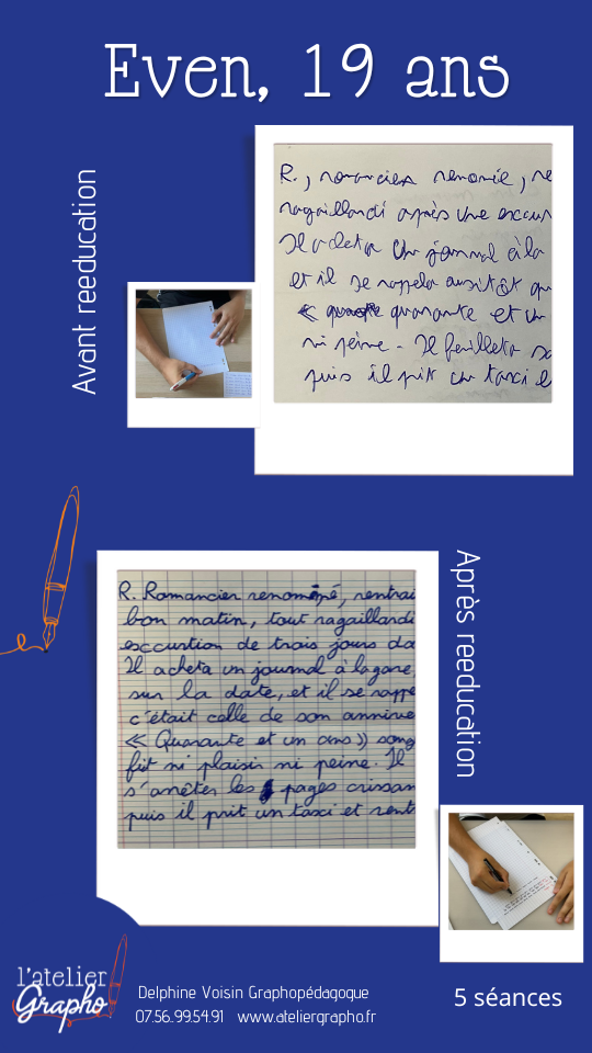 avant après rééducation écriture en classe prépa